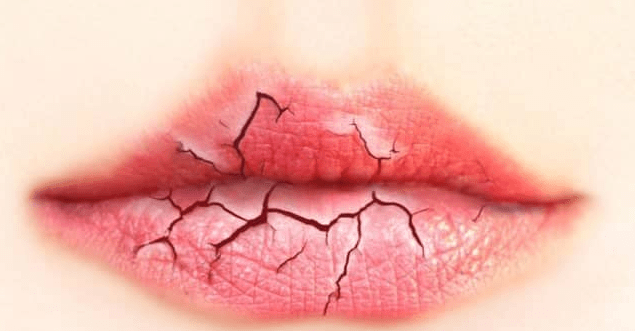  Ruj Uygulaması: Mükemmel Dudaklar İçin Adım Adım Rehber dudak-peelingi